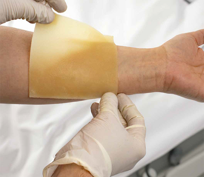 DynaSafety XeroBurn Sterile Burn Dressing 4x4 inch medical supply