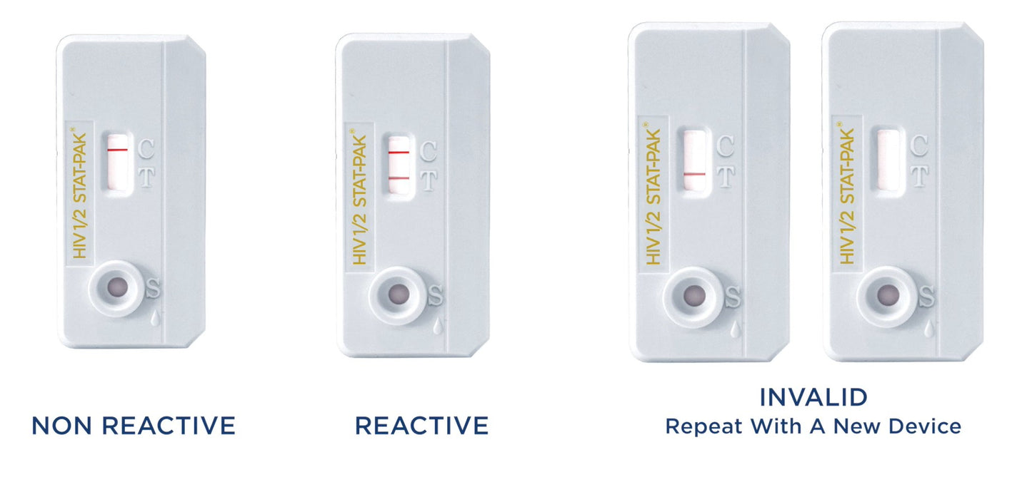 Chembio Diagnostics HIV 1/2 STAT-PAK Assay 20 Tests per Kit medical supply