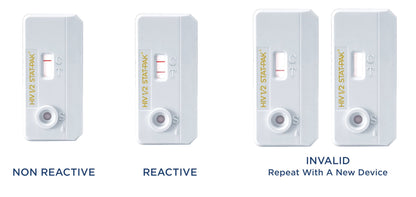 Chembio Diagnostics HIV 1/2 STAT-PAK Assay 20 Tests per Kit medical supply